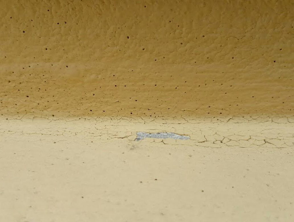 BỆNH LỖ KIM KHI THI CÔNG SƠN